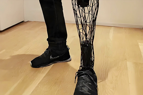 碳纤维假肢腿